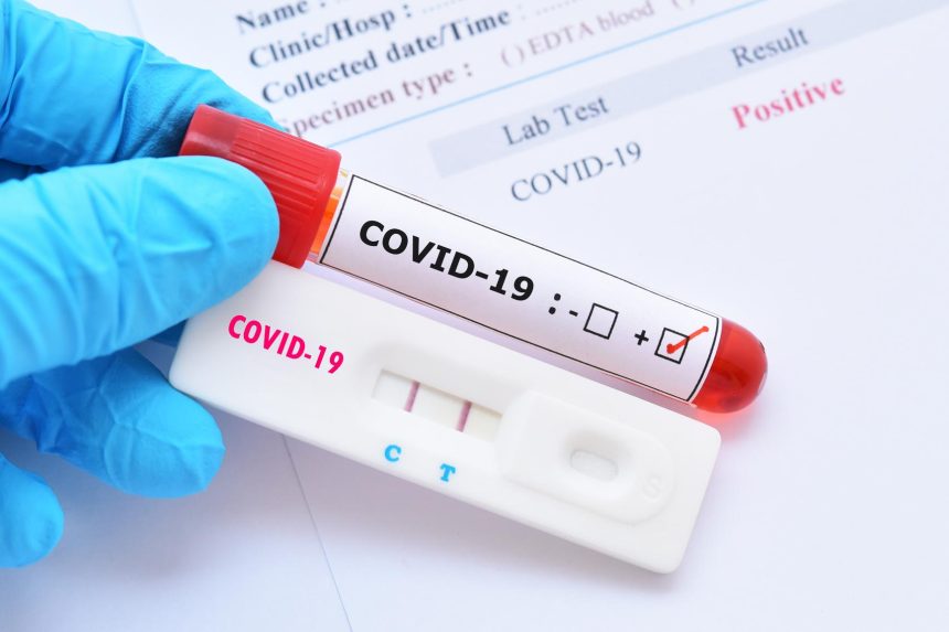 If you are vaccinated, can you travel without a COVID test?